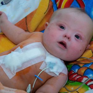 Chernobyl-Albina-6-months-CCI