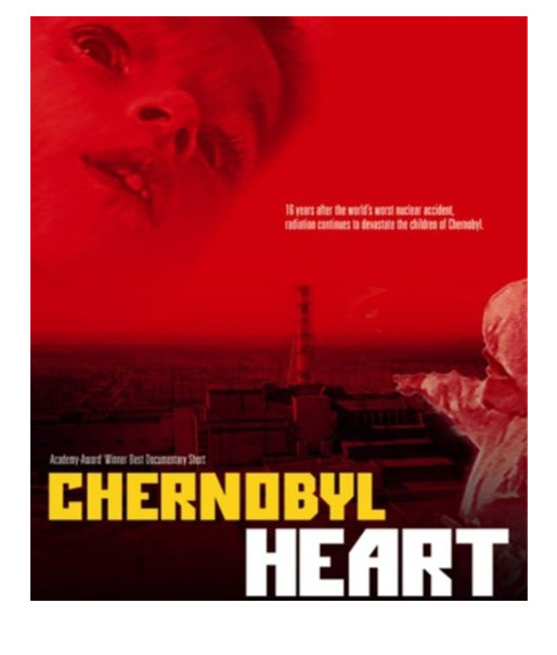 Chernobyl Heart Chernobyl Children International